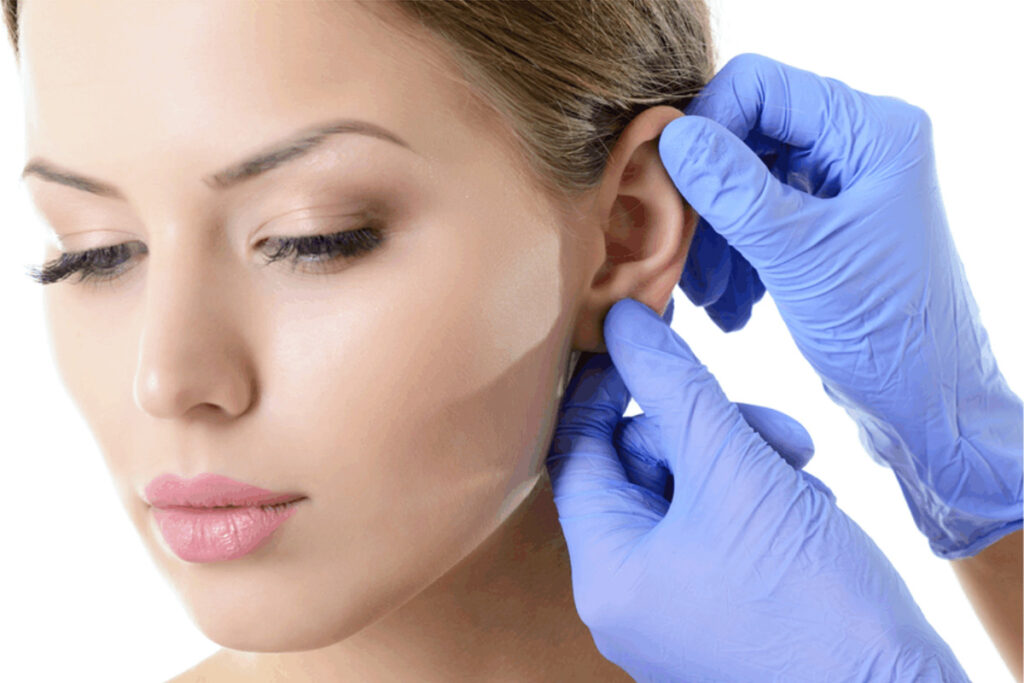 Cirugía de las orejas: Otoplastia