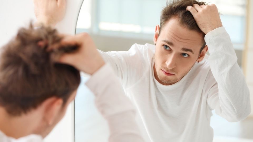 Blog 14 Cuando es mejor hacerse un injerto de pelo