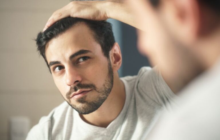 Que Hacer Si Se Te Cae Mucho El Cabello