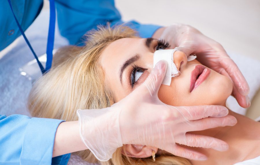 Procedimiento de rinoplastia explicado