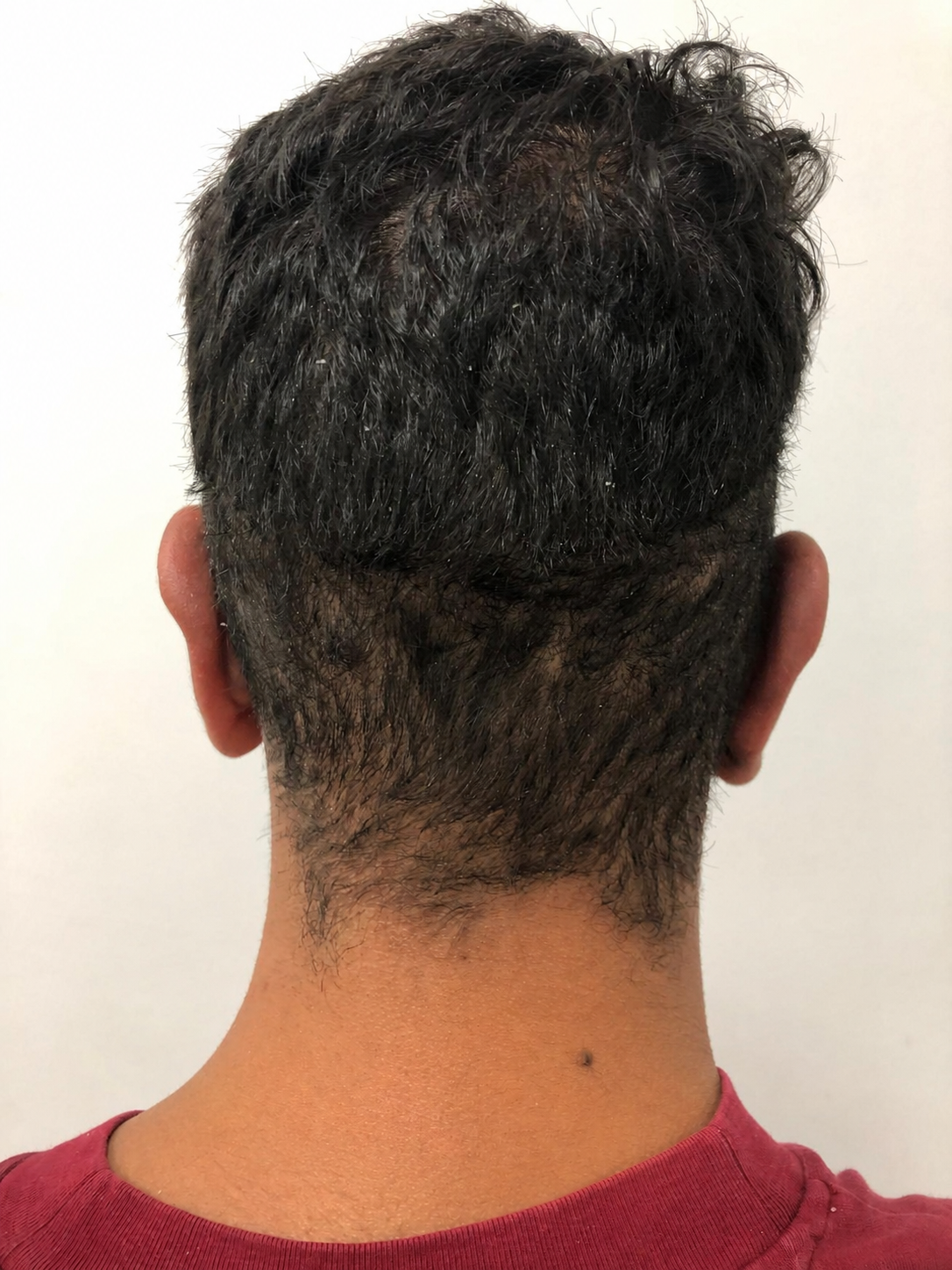Después Oreja Chico