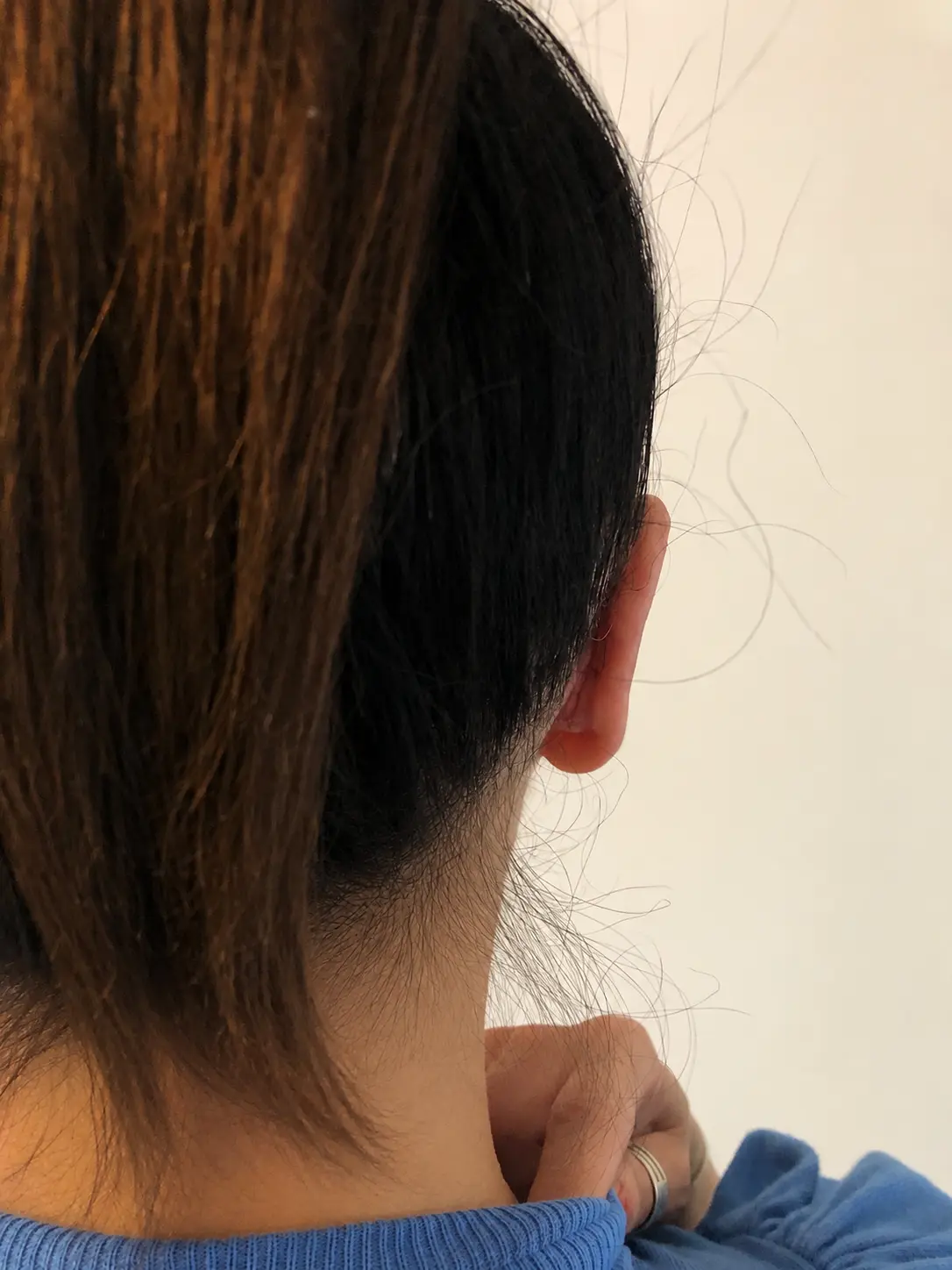 Después Oreja Chica