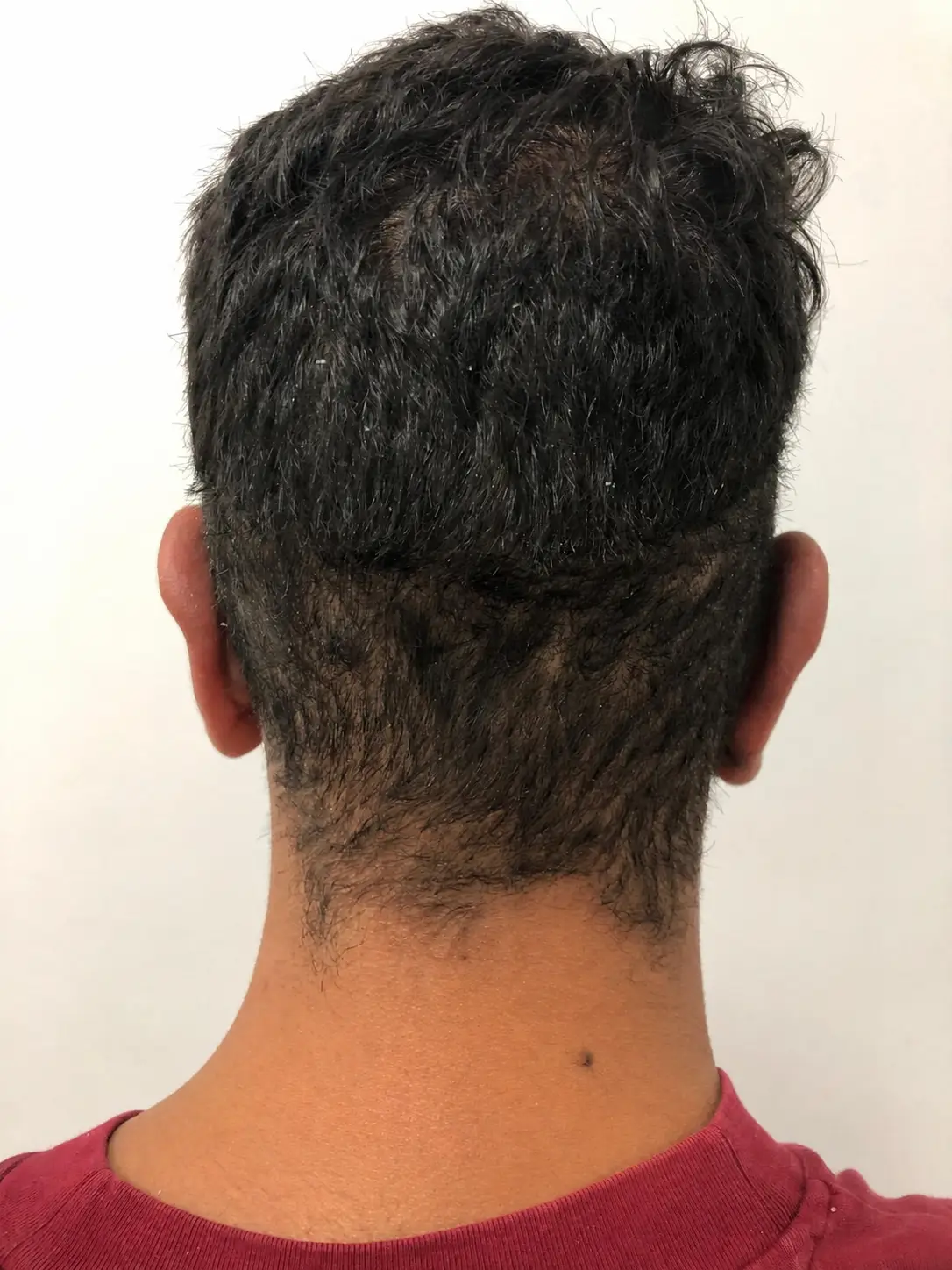 Antes Oreja Chico