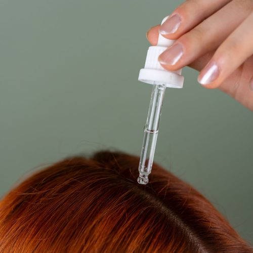 Mesoterapia capilar antes y después · Clínica Model Bell